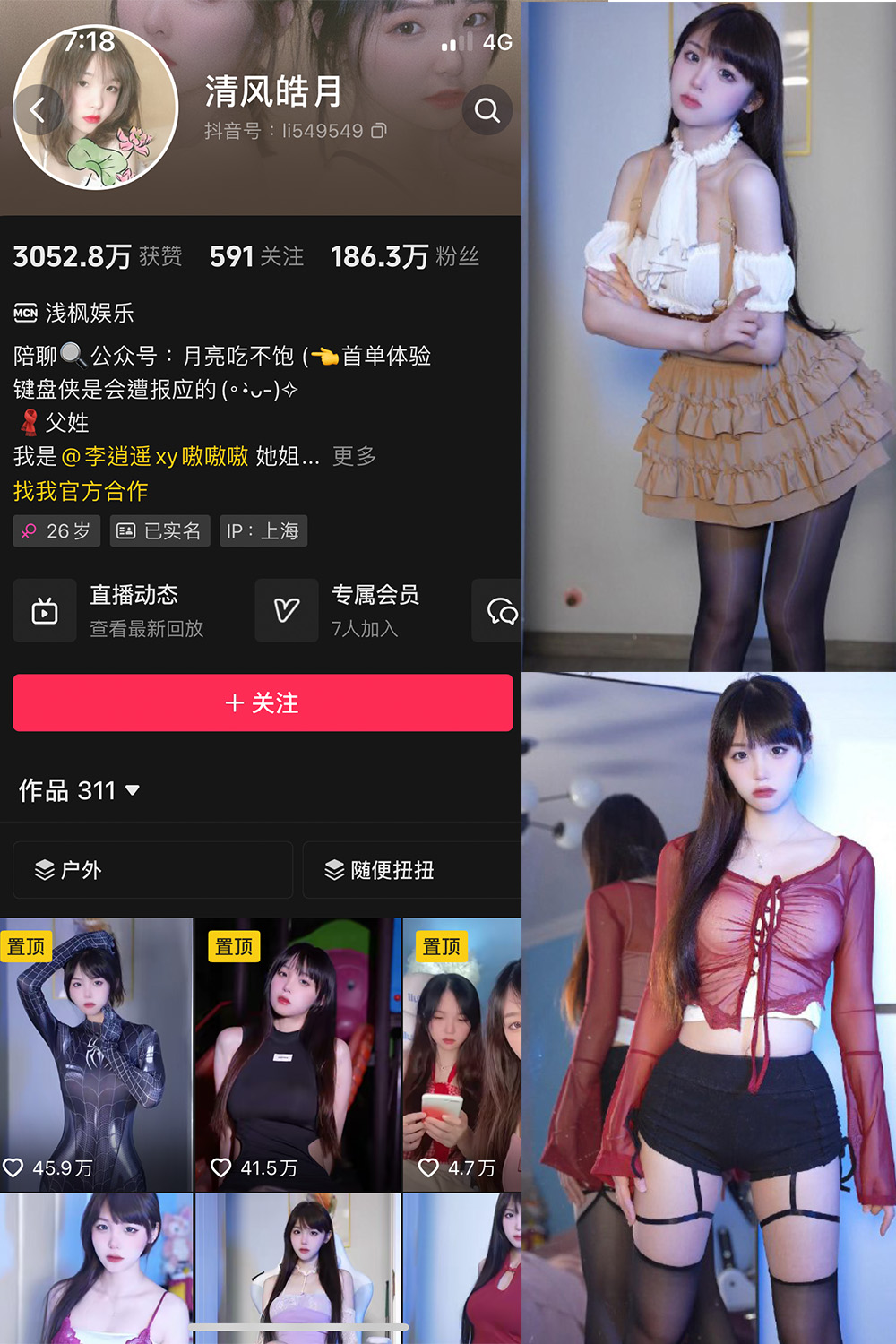 抖音 清风皓月 微密圈  NO.001期 【31P14V】-草莓酱