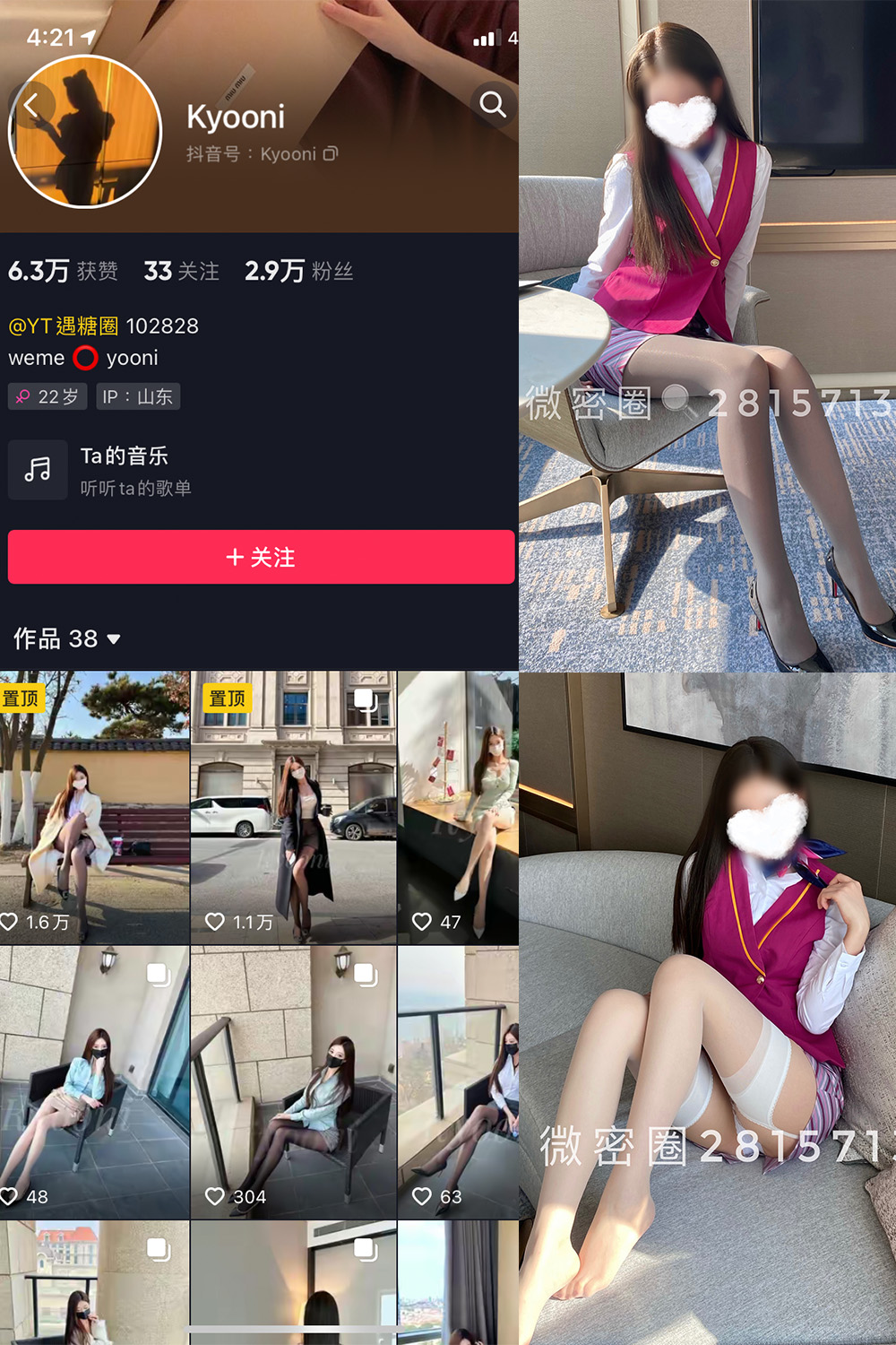 抖音 Yooni有你喵 微密圈  NO.004期 【49P】-草莓酱